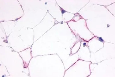 Glucagon receptor antibody