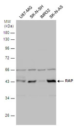 LRPAP1 antibody [N1C3]