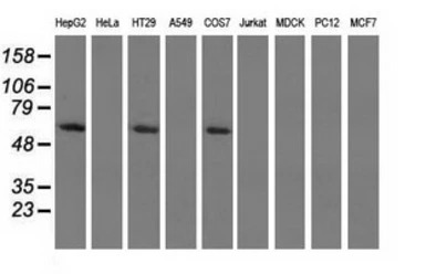 Pyruvate Kinase (liver/RBC) an