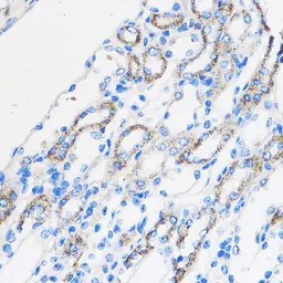 Chemerin antibody