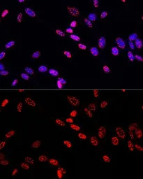 Histone H3T11ph (phospho Thr11