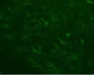KCNN3 antibody, C-term