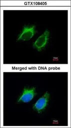 Inhibin beta A antibody
