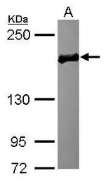EDC4 antibody
