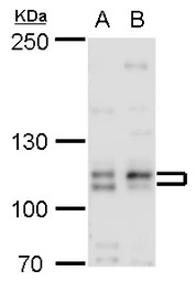 Cullin 4b antibody