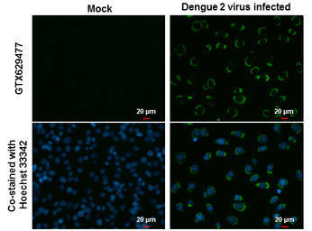 Dengue virus NS3 protein antib