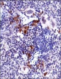 ATM (phospho Ser1981) antibody