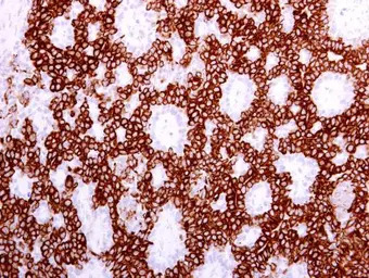 Cytokeratin 19 antibody [N1C1]