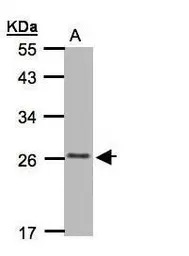 CKLFSF5 antibody [C2C3], C-ter