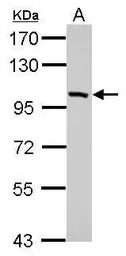 PDE11A antibody