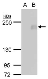 FIP200 antibody