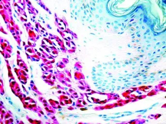 S100 antibody [4C4.9]