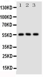 GLUT5 antibody