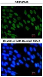 ZNF198 antibody