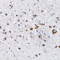 Retinoic Acid Receptor alpha a