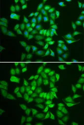 Casein Kinase 1 epsilon antibo