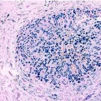 普鲁士蓝染色(铁染色)