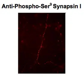 Synapsin I (phospho Ser9) anti