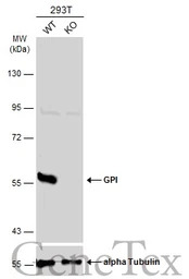 GPI antibody