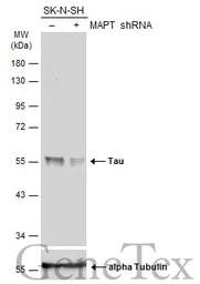 Tau antibody