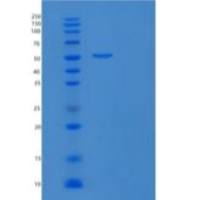 人DCBLD2/ESDN重组蛋白C-6His