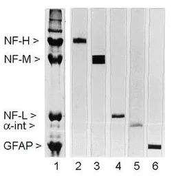 NF-M antibody [3H11]