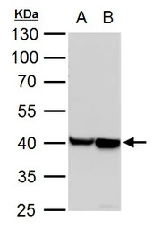 alpha Cardiac Muscle Actin ant