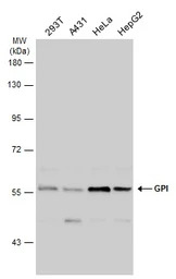 GPI antibody