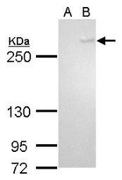 TET1 antibody [GT465]