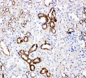 GLUT5 antibody