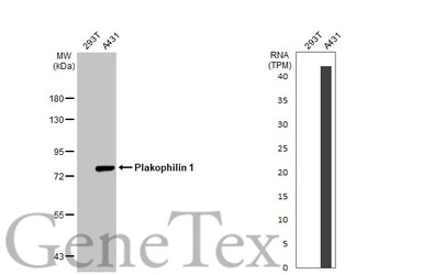 Plakophilin 1 antibody [N2C1],