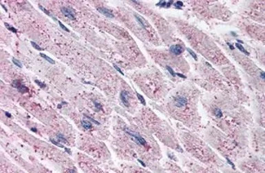 Endothelin A receptor antibody