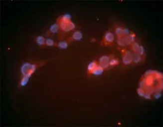 LDL Receptor antibody [15C8]