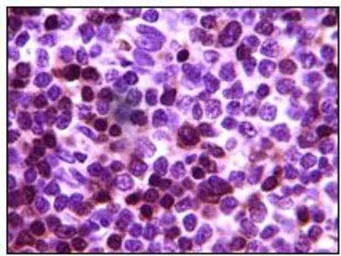 ZAP70 antibody [3D2A4]