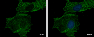 alpha Cardiac Muscle Actin ant