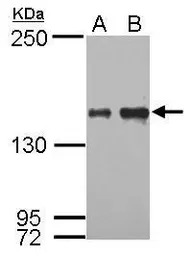 IKAP antibody [C1C2], Internal