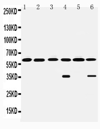Monoamine Oxidase B antibody