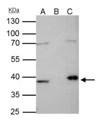 Fibrillarin antibody