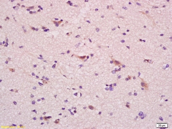 ganglioside GM1 antibody