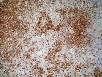 CD4 (Domain 1) antibody [OX-38