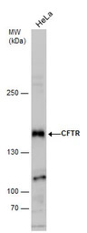CFTR antibody