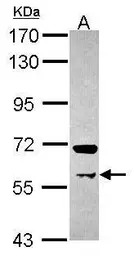 PRMT3 antibody