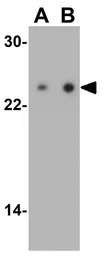 TIRAP antibody
