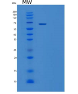 人血清白蛋白/HSA重组蛋白C-8His