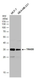 TRADD antibody