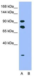 HIPK2 antibody, Internal