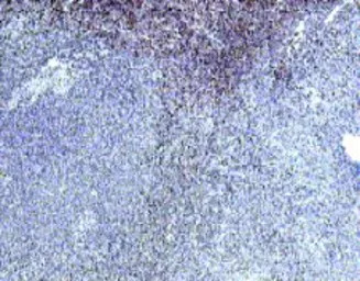 IL22 Receptor alpha 1 antibody