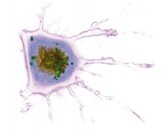 360度全息3D活细胞成像系统