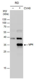 Coxsackievirus A6 VP1 antibody