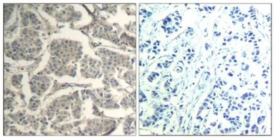 Cofilin1/Cofilin2 antibody